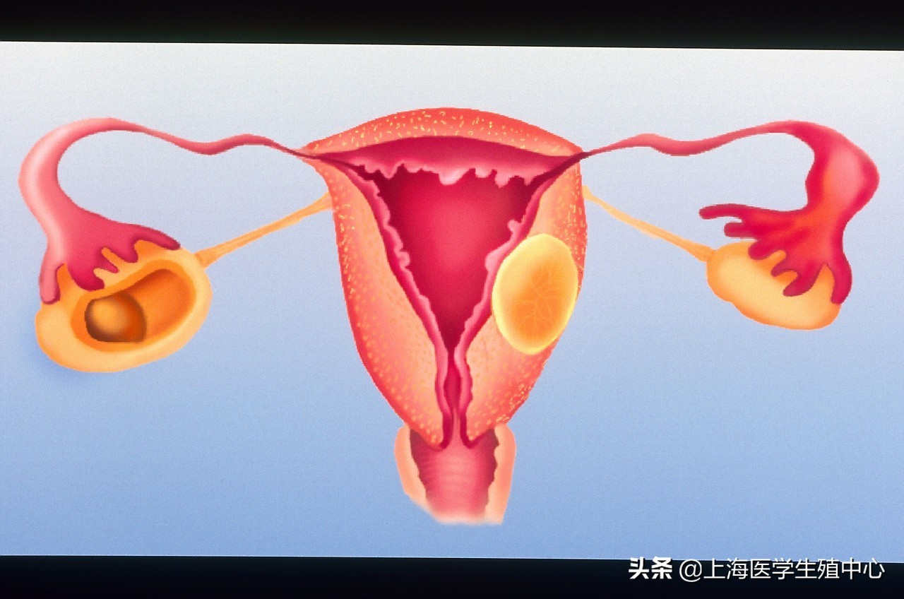检查输卵管通不通哪种方法最好,做输卵管造影什么时候检查白带