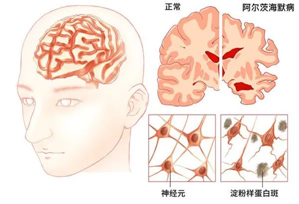 “脑袋不中用喽”，是哪个环节出了问题？怎么办！