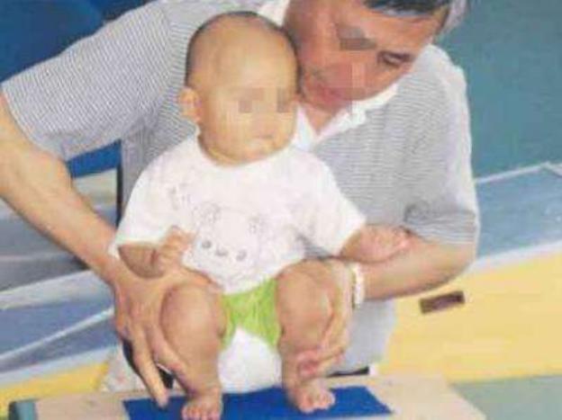 宝宝看手和脑瘫的区别,宝宝开始发育正常后面还会脑瘫吗