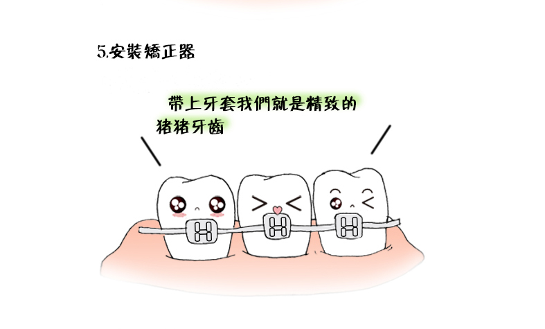 牙齒矯正的步驟是怎樣的呢？看完這個漫畫你就知道了