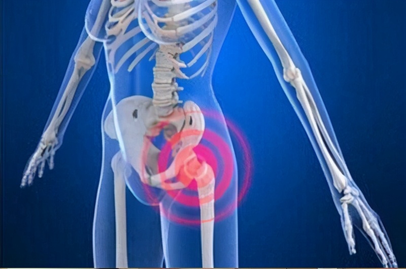 髋关节滑膜炎中药方,髋关节滑膜炎儿童