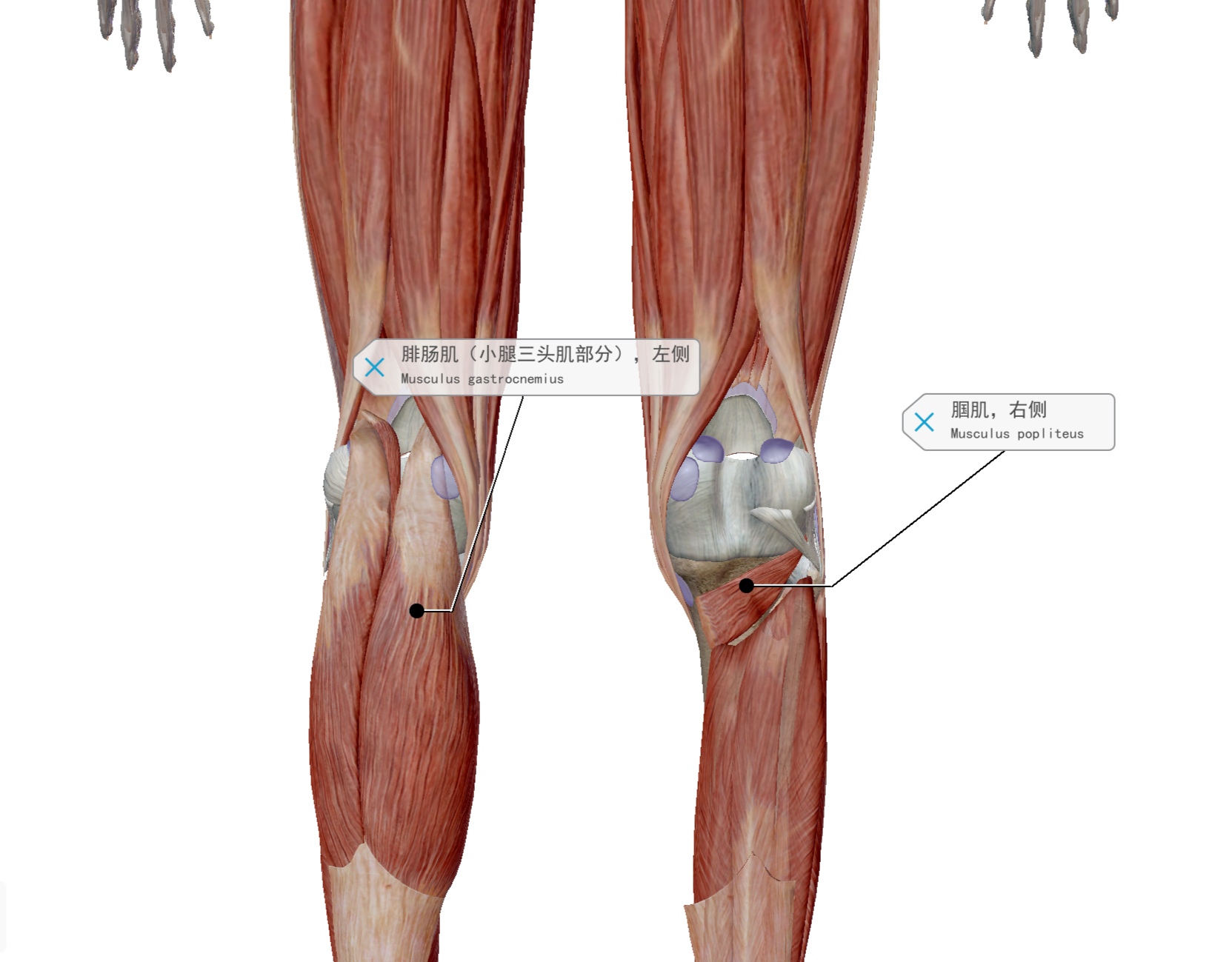 怎样区分腘肌疼和膝盖疼,你不了解的腘肌