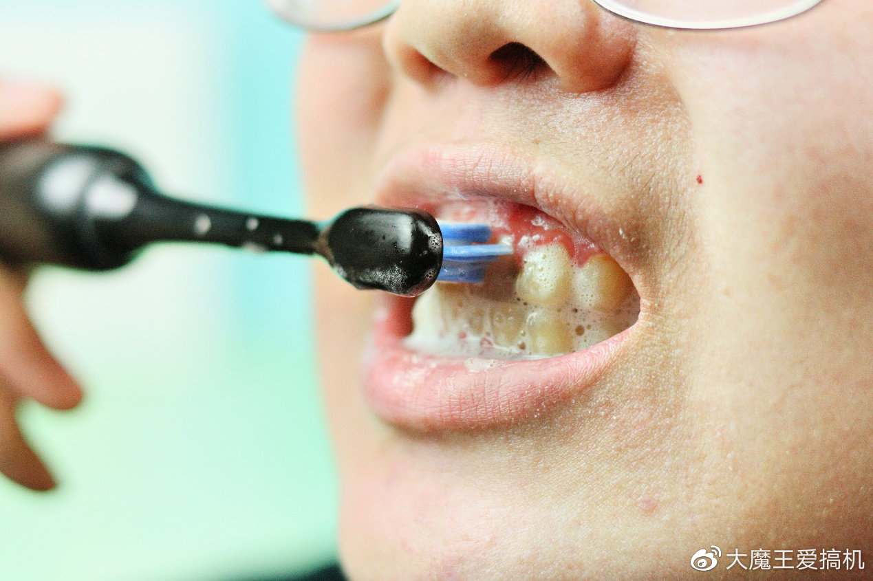 黑科技抗敏感牙膏,黑科技牙膏让烂牙齿变白