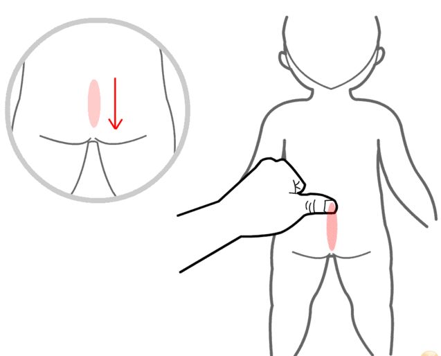 新生儿肠胀气最好的解决方法,新生儿肠胀气有什么解决方法
