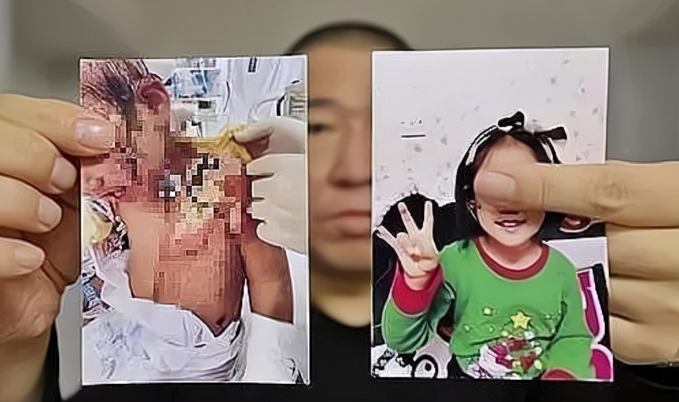 6岁女童被亲妈虐待怎么回事,6岁女童被亲妈虐待怎么发现