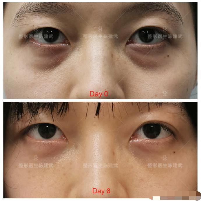 24岁女孩哭诉委屈下场完整版,24岁女孩哭诉委屈完整版