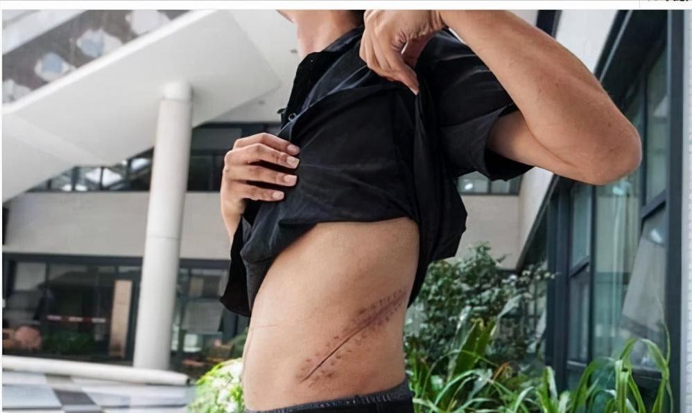 安徽17岁高中生，2万卖肾买苹果手机获巨额赔款，现在过得怎么样