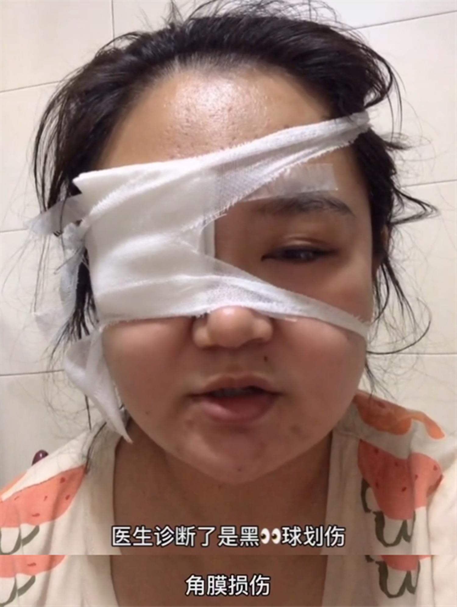 婴儿眼睛被戳到怎么判断严不严重,宝宝眼睛被戳了一直流泪严重吗