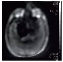 农场里走出CT鼻祖，美苏核危机诞生磁共振