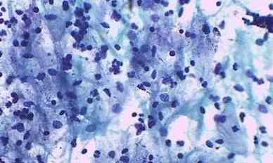 妇科疾病有哪些严重的后果,女性妇科危险信号