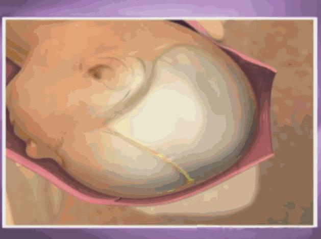 顺产生孩子剖腹产的真实流程,顺产剖腹产生孩子的真实流程