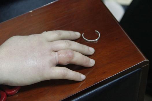 孕妈佩戴珠宝,孕期戴首饰有辐射吗