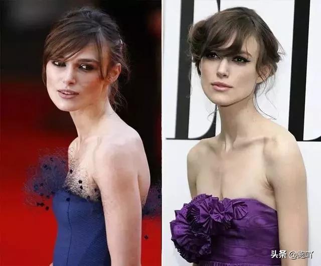 跑后肩部疼痛最快缓解方法,肩颈酸痛是什么原因