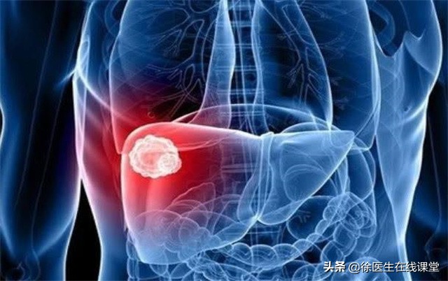 乙肝转氨酶高先保肝还是先抗病毒,乙肝抗病毒后还要吃护肝药吗