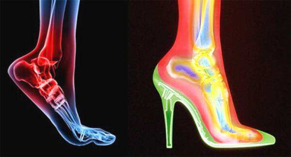 背单肩包会不会引起脖子疼,背单肩包会腰疼吗