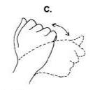 足舟骨骨折康复训练视频教程,腕舟骨骨折打了石膏康复需要多久