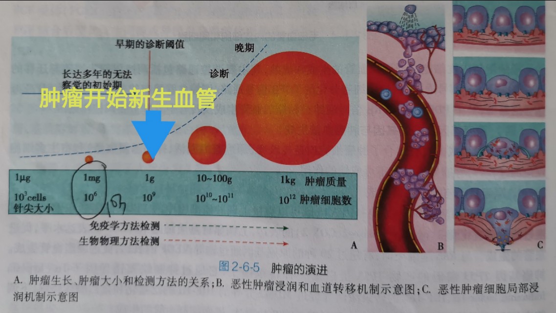 饿死癌细胞的靶向新药,肺癌晚期饿死了怎么办
