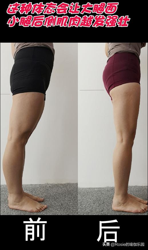 锻炼小腿内侧肌肉改善O型腿,小腿粗大腿壮如何变细腿