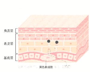 色斑皮肤问题及护肤解决方法,色斑护肤知识