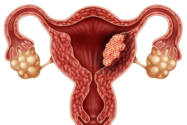 hpv感染医生让用干扰素,hpv感染医生说做环切术