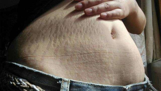 Ella生育后遗症：打喷嚏、跑步都会尿*禁失**！产后这样做可预防