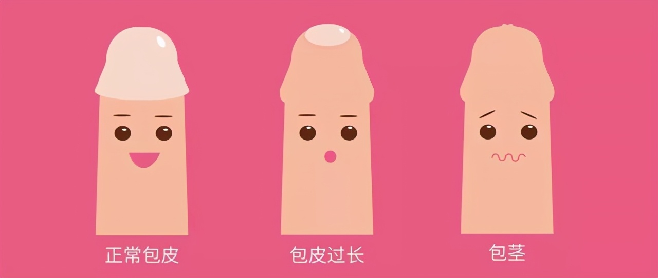 为什么会感觉尿频尿急,为啥会尿急