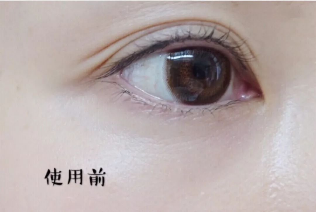 林允张韶涵面膜,林允同款眼膜推荐