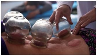 艾灸和拔罐哪个可以祛除湿气,湿气重直接艾灸还是先拔罐再艾灸