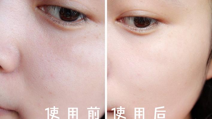 城野医生改善毛孔,城野医生牌子还能买吗