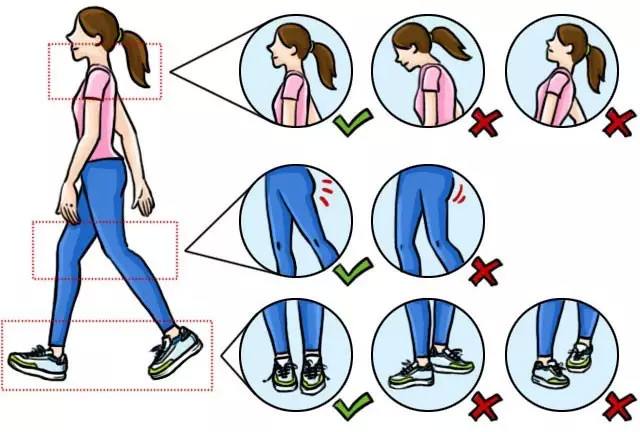 腿型管理腿不直改善各种不良腿型,腿部粗壮一般都会有腿型问题吗