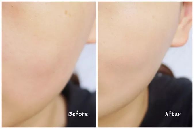 olay和欧莱雅哪个好性价比高,欧莱雅和olay哪个高档一点