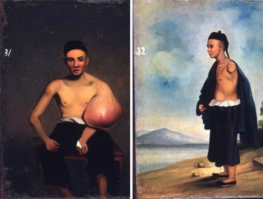 谁给中国做了贡献,中国最早现代医院