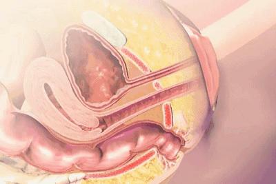 男怕前列腺有事，女怕阴道松弛！一个小动作能治也能防，便秘、痔疮也用得上