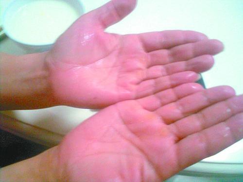 经常出汗量大，说明身体健康有问题吗？告诉你真正要注意的情况