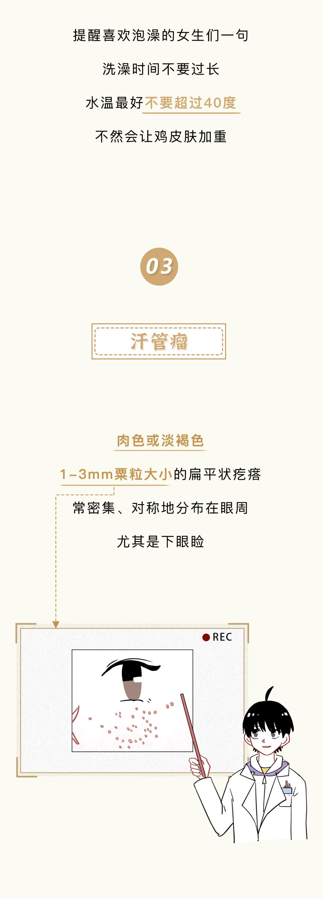 眼睛周围为什么会有脂肪粒,眼睛周围的脂肪粒怎么造成的