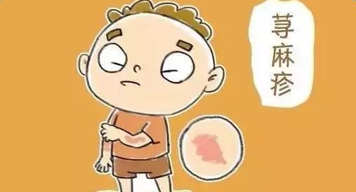 季节荨麻疹最简单自愈方法,换季荨麻疹怎么根除