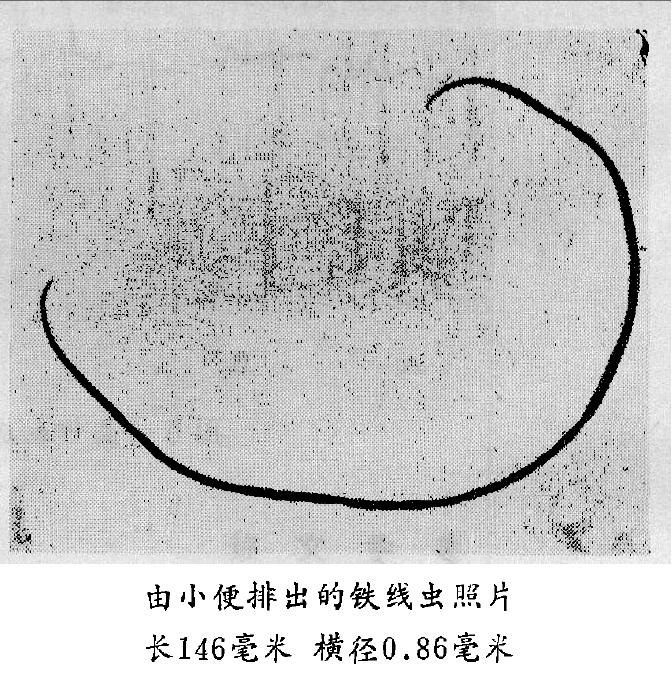 铁线虫来袭，能操纵螳螂“自杀”的寄生虫，能否控制人类？