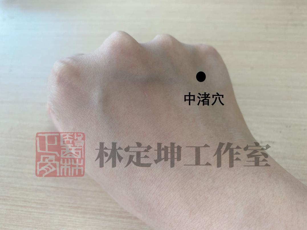 董氏治疗颈肩痛,安氏新汉方治肩颈痛方法