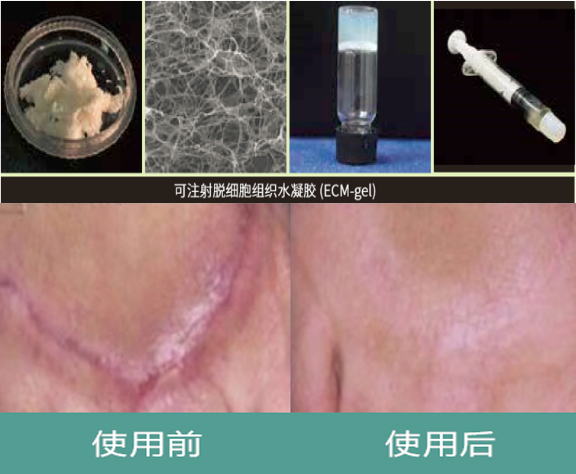 执研BASICBASE：脱细胞真皮基质分析及应用