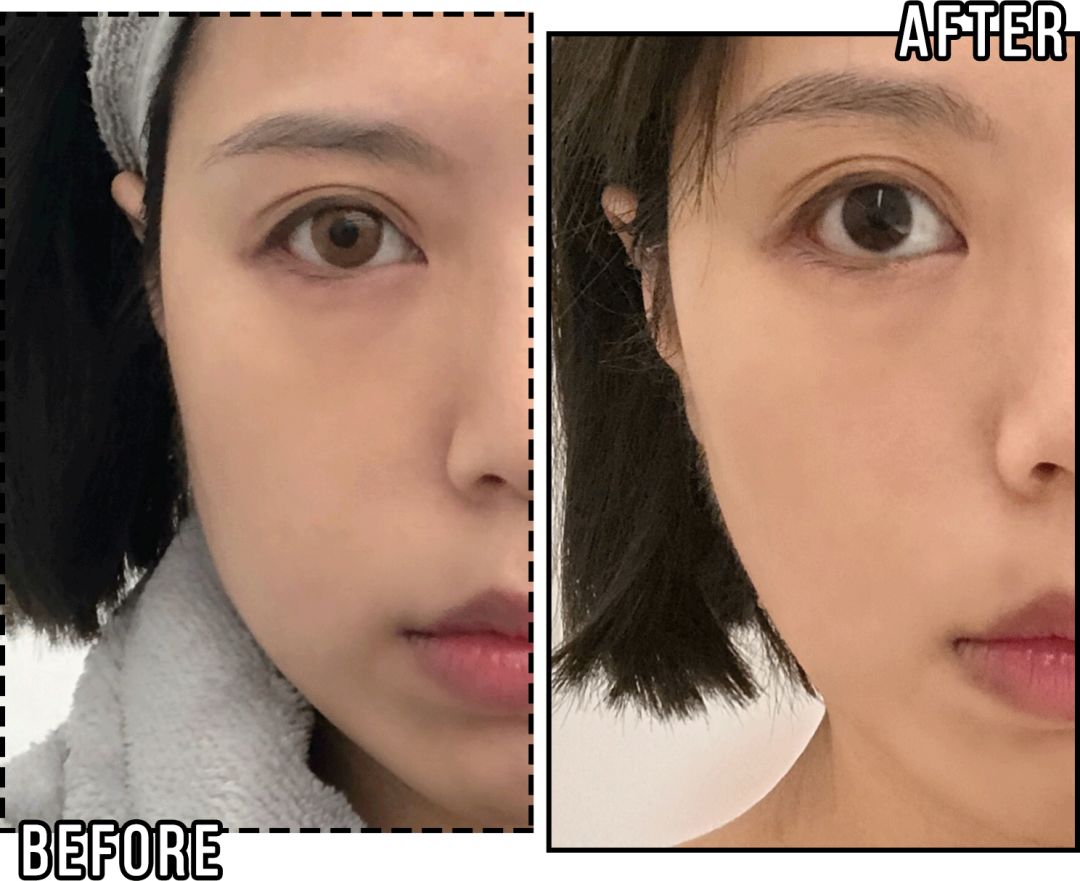 花3000块做一次皮肤护理我后悔吗,皮肤提拉效果怎么样