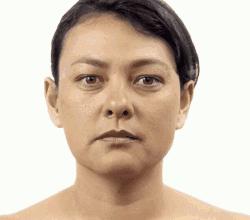 头发白了有什么方法变黑小妙招,头发白了怎么办白发变黑妙招