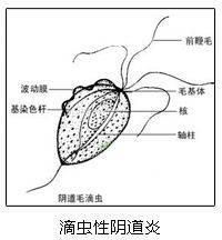 妇科病白带多有异味用什么药,医生问平时白带多不多怎么回事