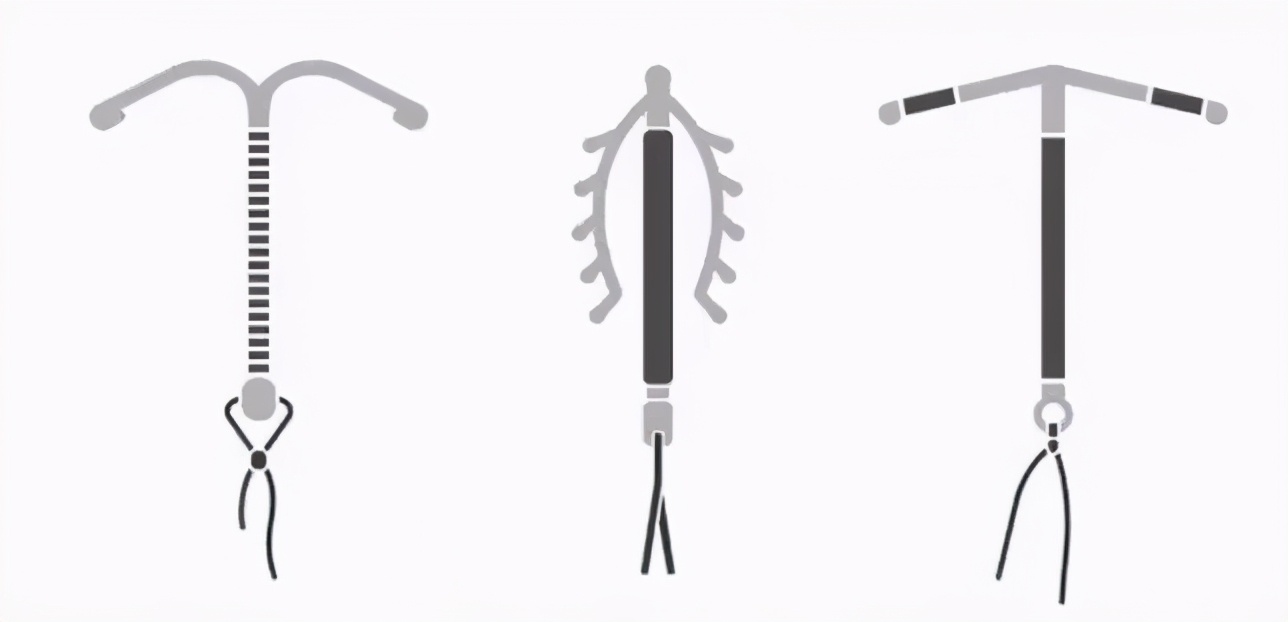 绝经后节育环长肉里怎么取,节育环嵌入肉里怎么办