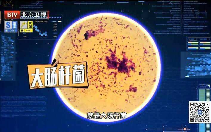 裤底老是湿湿的是怎么回事,裤头总是脏脏的咋回事