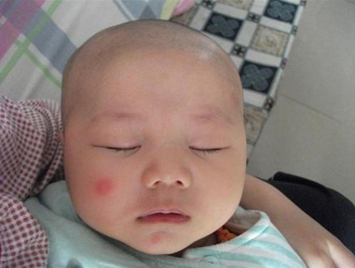 蚊子咬了宝宝能涂花露水吗,蚊子咬了宝宝的手可以涂花露水吗