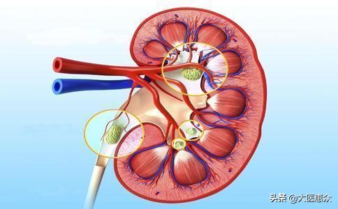 尿很骚是什么气味,尿很骚是什么原因引起的