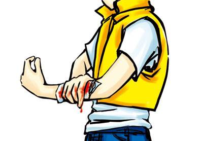 受伤了需要打破伤风吗,受伤了要去诊所吗