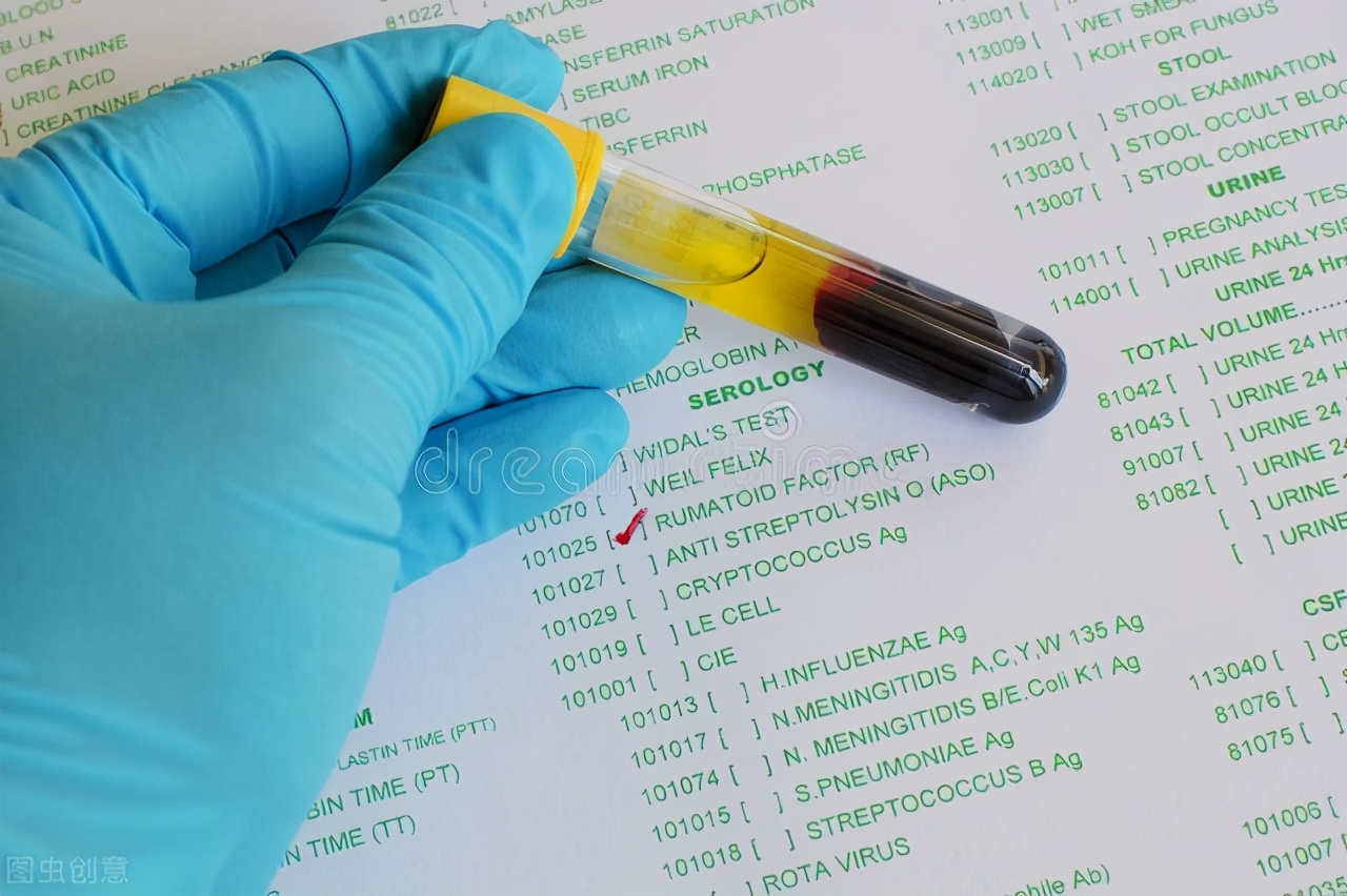 诊断类风湿的四个标准是什么,诊断类风湿关节炎的六条指标