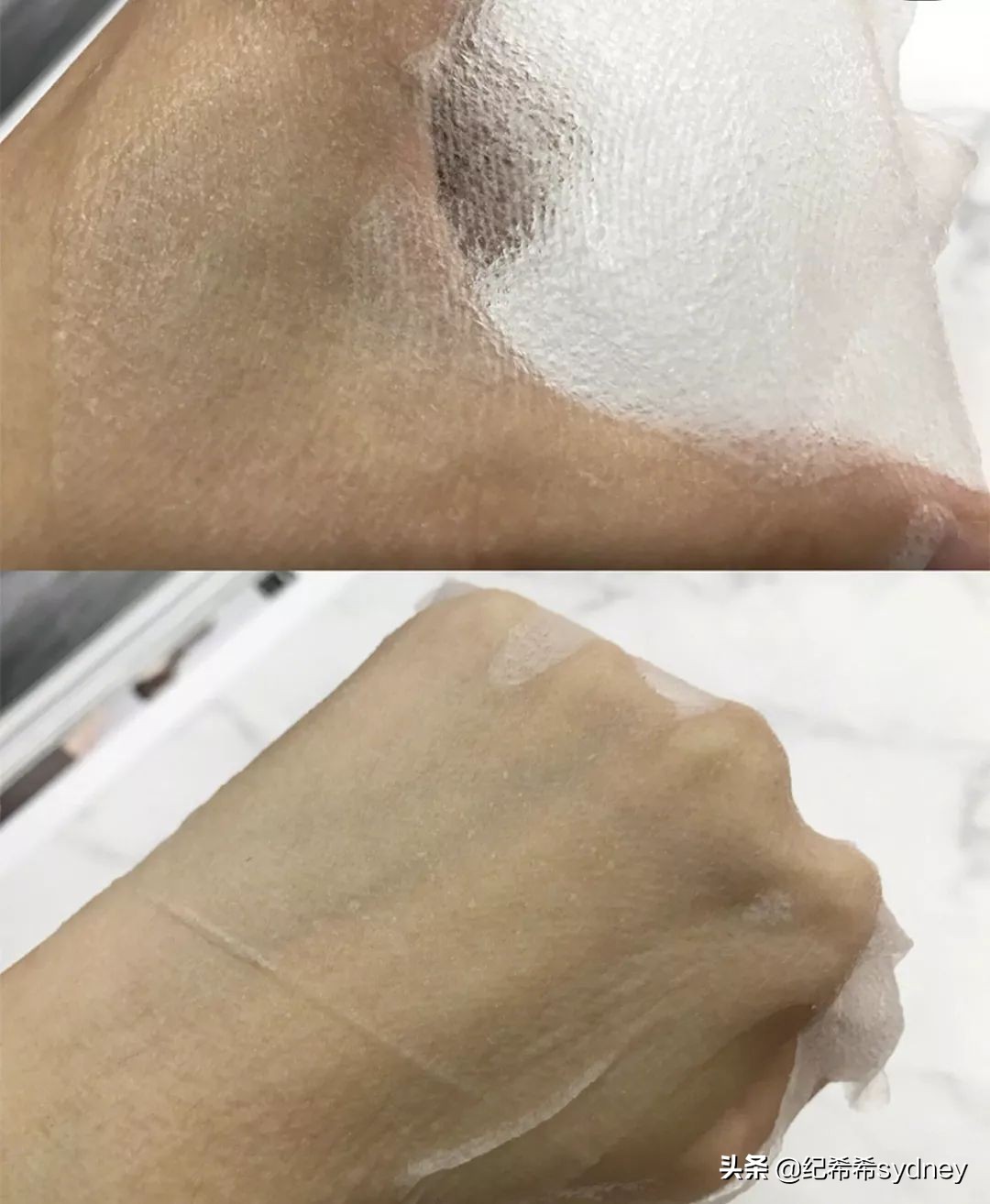 为什么很多人都去做医美了,为什么很多人医美会失败