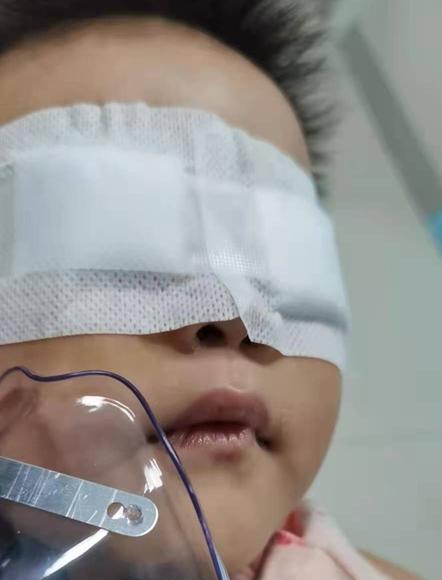 一岁宝宝长了霰粒肿多久能自愈,刚满1周岁宝宝霰粒肿怎么办